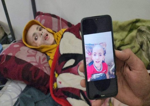تحذير أممي من "انفجار وشيك" في عدد وفيات الأطفال بغزة جراء سوء التغذية